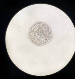 Image of a blastocyst under a microscope.