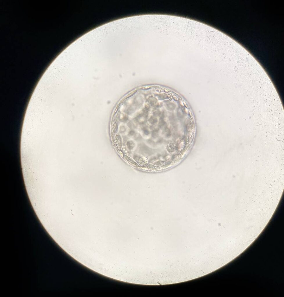 Image of a blastocyst under a microscope.